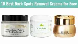 Dark spot