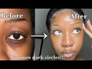 Dark Circle