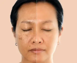 Dark Spot Correctors