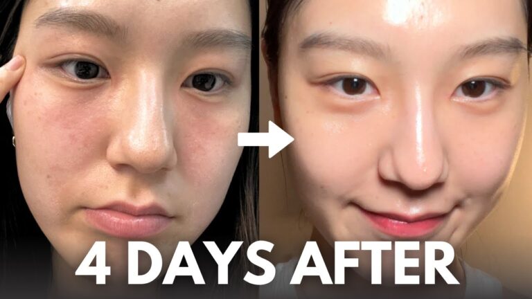How I Repair My Skin Barrier in 4 Days