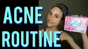 Effective Acne Routine
